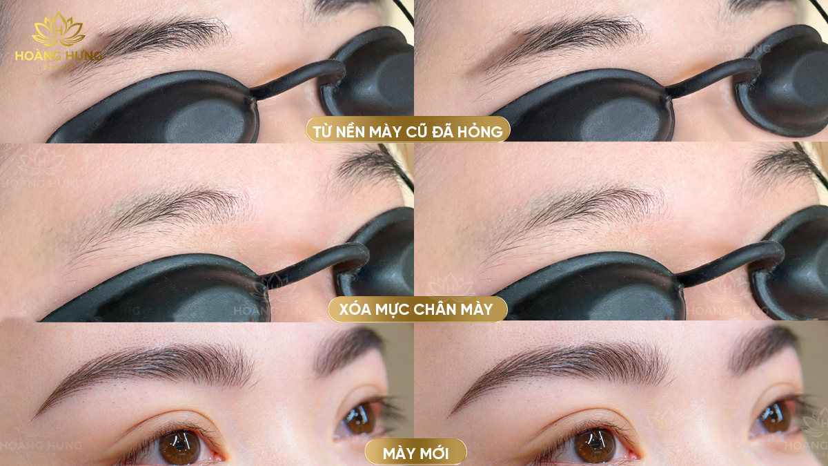 Xử lý nền cũ đúng hướng giúp việc thiết kế dáng mới chủ động hơn, đặc biệt khi dáng trước đó quá rộng hoặc không còn phù hợp.