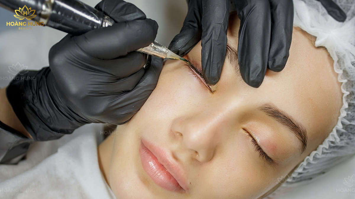 Cận cảnh quá trình phun mí mở tròng tại Hoàng Hưng Beauty