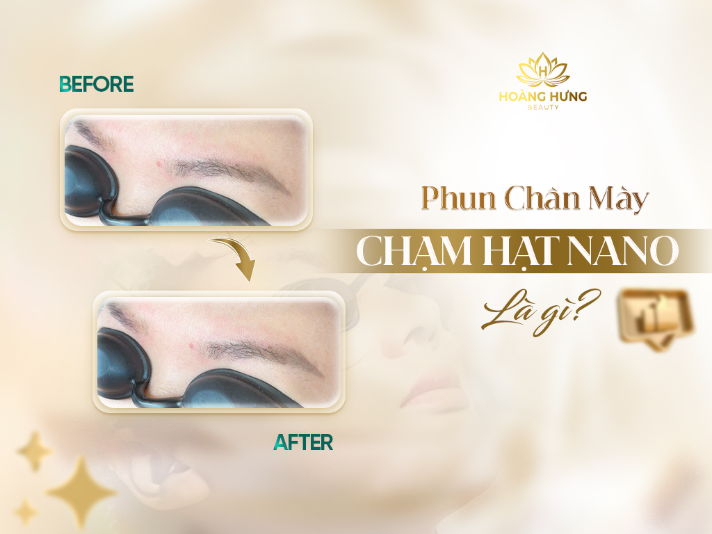 Phun Chân Mày Chạm Hạt Nano Giá Bao Nhiêu 6 Điều Cần Biết Trước Khi Làm