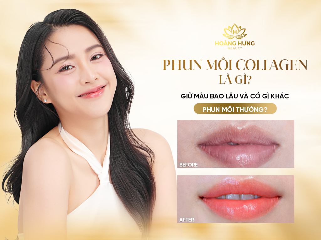 Phun Môi Collagen Là Gì Giữ Màu Bao Lâu Và Có Gì Khác Phun Môi Thường