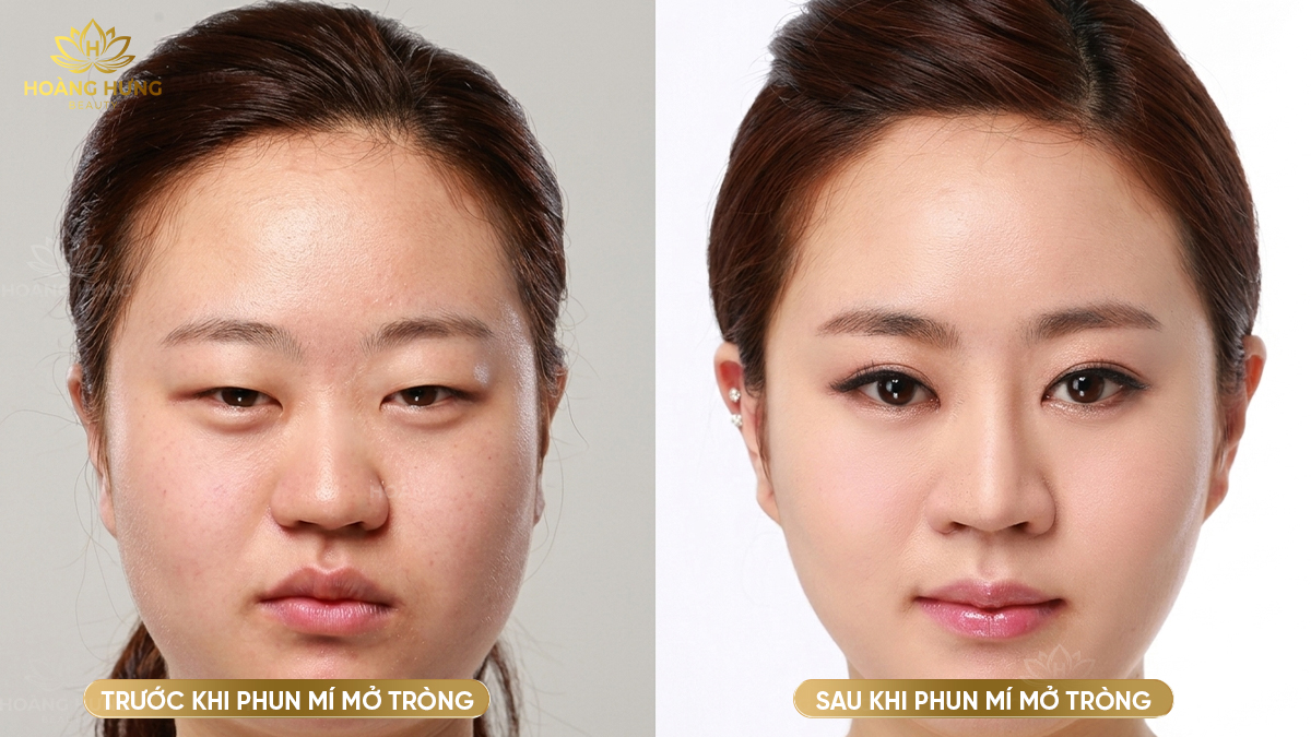 Phun mí mở tròng tạo đường viền mí rõ hơn, giúp ánh nhìn nổi bật và có chiều sâu.