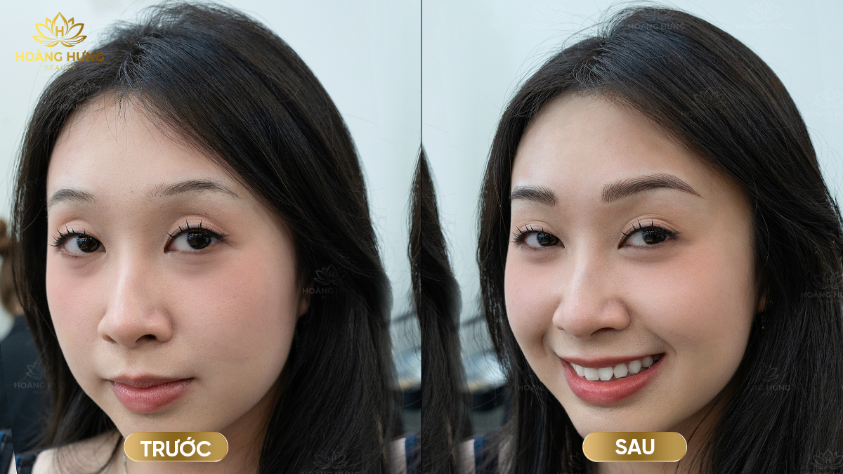 Xăm Chân Mày Hairstroke Hay Xăm Sợi? 5 Điểm Khác Biệt Giúp Bạn Chọn Đúng Kiểu Mày 3 Xăm chân mày Hairstroke theo xu hướng mày sợi tự nhiên